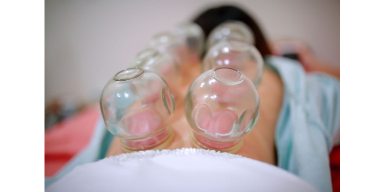 Bańki lekarskie - od terapii naszych babć do medycyny chińskiej