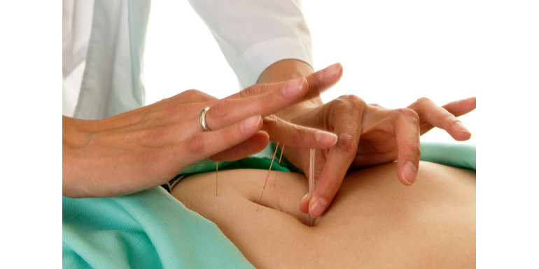 Czy warto korzystać z prowadnic do igieł akupunkturowych?