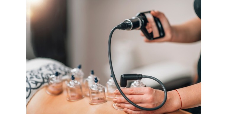 Jak stawiać bańki bezogniowe z pompką?