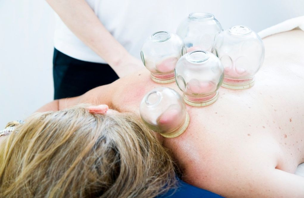 Chinese cupping massage - learn about the effects